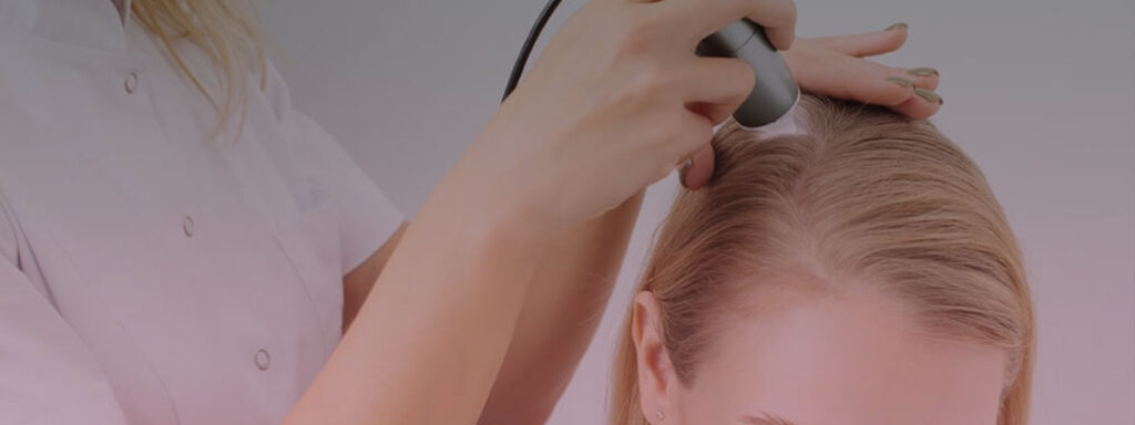 درمان کم پشتی مو در زنان