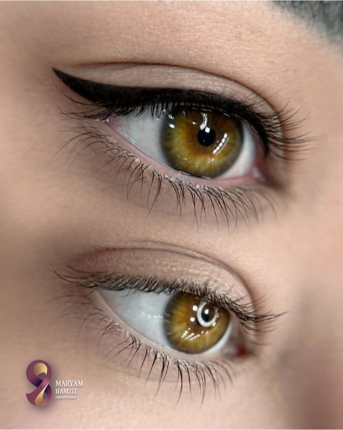 خدمات بن مژه در مرکز مریم حمزه ای