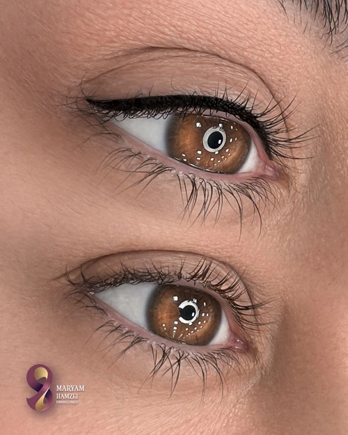 بن مژه با پیگمننر فرزانه
