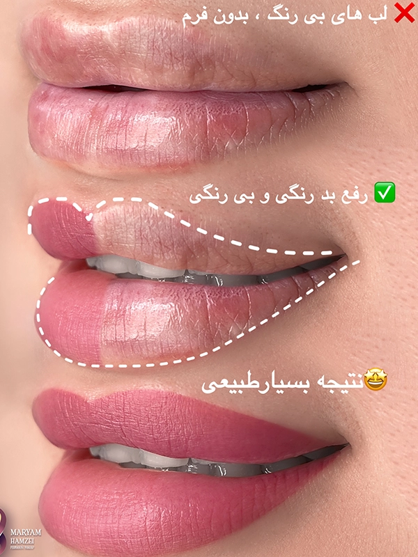 اقدامات قبل از شیدینگ لب