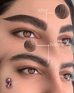 نمونه کار میکروبلیدینگ ابرو در مرکز تخصصی مریم حمزه ای
