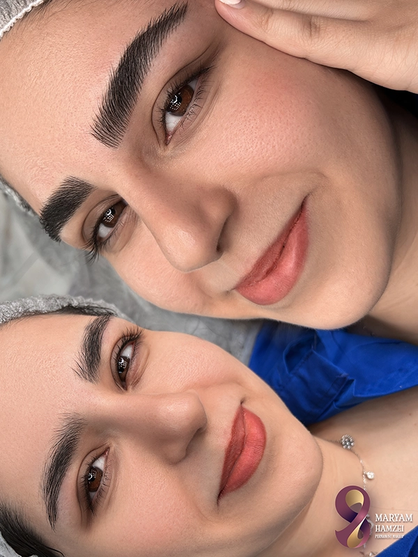ابروی فیبروز شده در مرکز زیبایی مریم حمزه ای