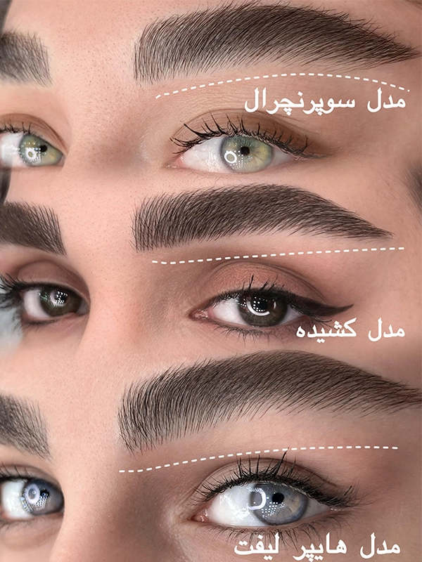 ماندگاری فیبروز ابرو