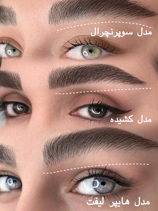 ماندگاری فیبروز